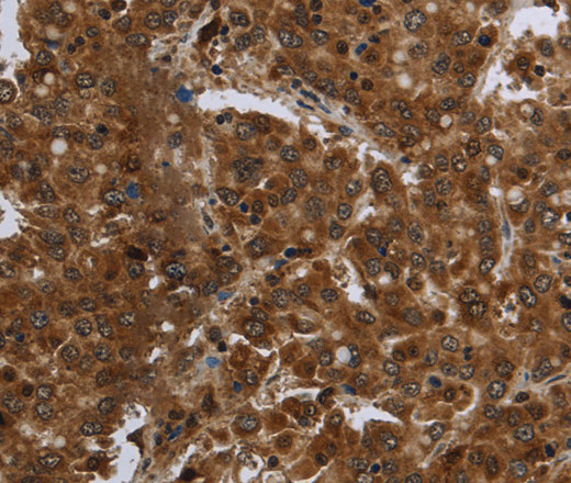 FASTKD1 Polyclonal Antibody (E-AB-11221)