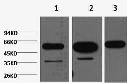 beta Tubulin Monoclonal Antibody (E-AB-20093)