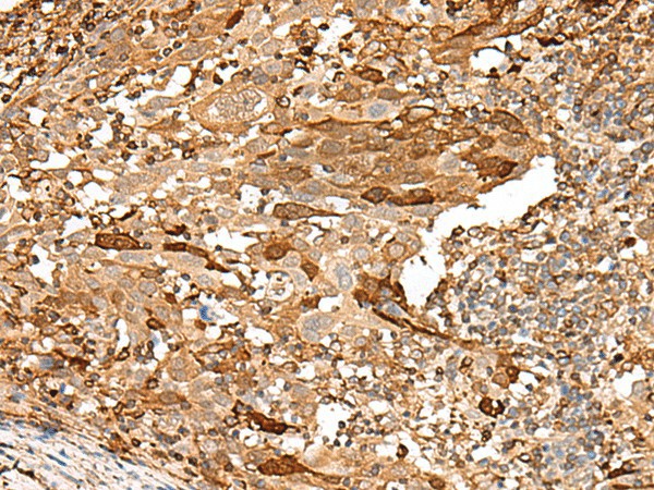 PIEZO2 Polyclonal Antibody (E-AB-17942)