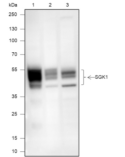 Recombinant SGK1 Monoclonal Antibody (AN301954L)