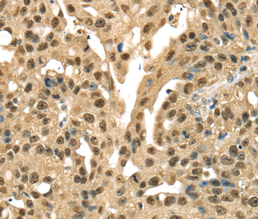 DFFA Polyclonal Antibody (E-AB-10383)
