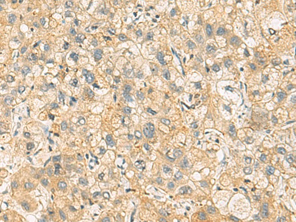 NANP Polyclonal Antibody (E-AB-19191)