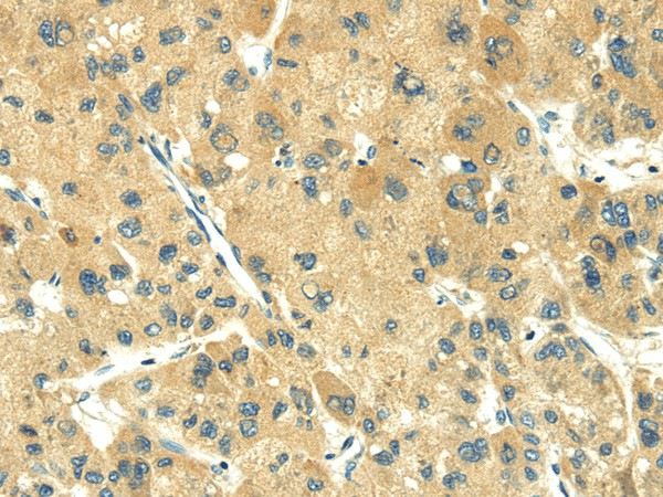 TRIM10 Polyclonal Antibody (E-AB-17091)
