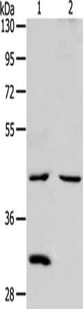 NCEH1 Polyclonal Antibody (E-AB-10691)
