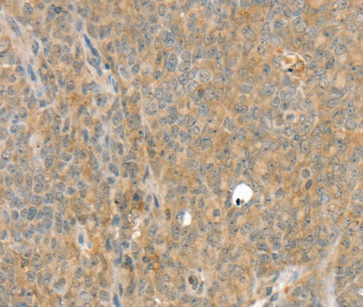 SLC8A3 Polyclonal Antibody (E-AB-16847)