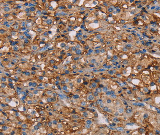 NEDD4L Polyclonal Antibody (E-AB-15252)