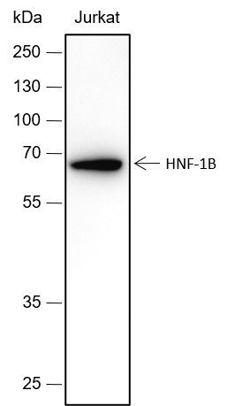 Recombinant HNF-1B Monoclonal Antibody (AN301726L)