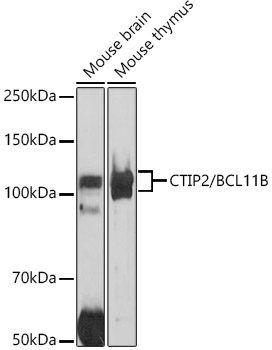 CTIP2/BCL11B Polyclonal Antibody (E-AB-92261)