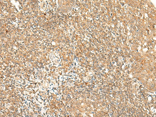 GPR89A/GPR89B Polyclonal Antibody (E-AB-18049)