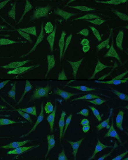 GAPVD1 Polyclonal Antibody (E-AB-67056)