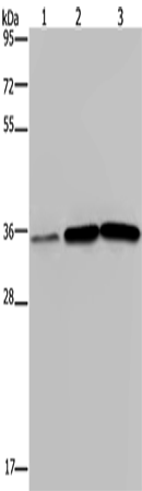 MAGEA3 Polyclonal Antibody (E-AB-12753)
