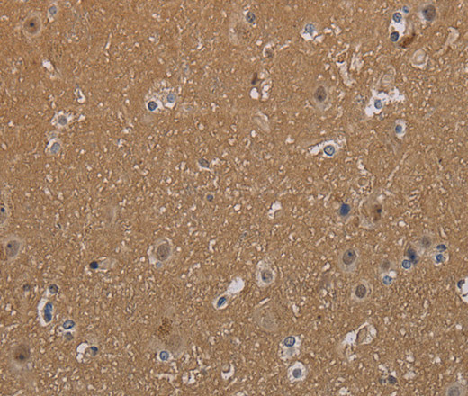 MAGEL2 Polyclonal Antibody (E-AB-13399)