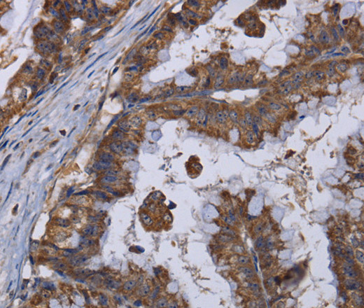 MT3 Polyclonal Antibody (E-AB-15198)