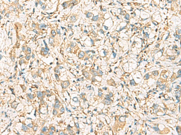 IDS Polyclonal Antibody (E-AB-19223)