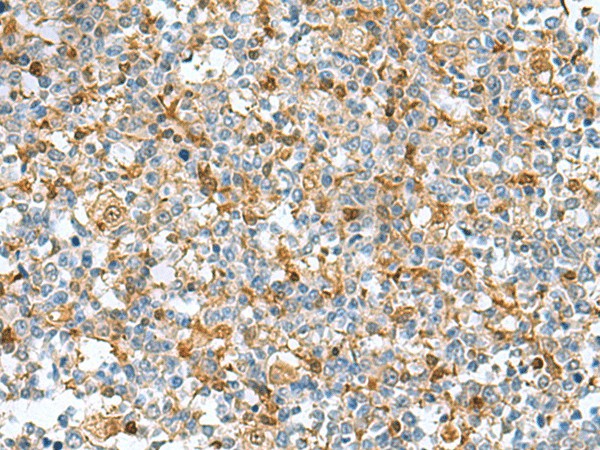 DNPH1 Polyclonal Antibody (E-AB-53062)
