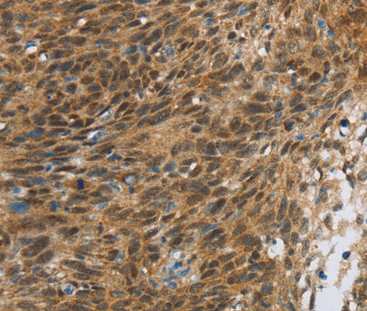 FOXB1 Polyclonal Antibody (E-AB-12418)