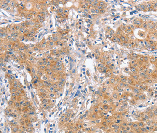 ATG12 Polyclonal Antibody (E-AB-14584)