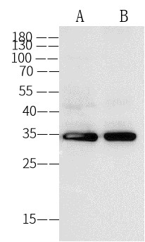 Annexin V/ANXA5 Monoclonal Antibody (AN200058P)
