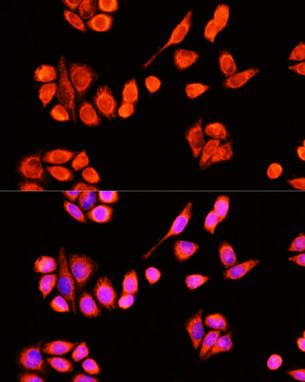 DNAJC19 Polyclonal Antibody (E-AB-66373)