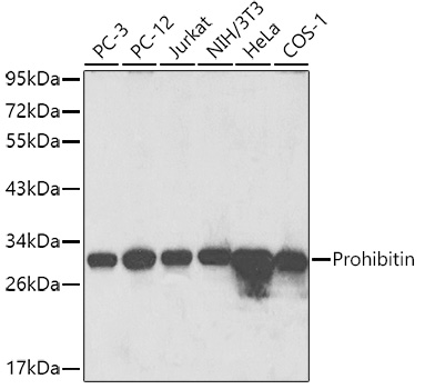 PHB Polyclonal Antibody (E-AB-66098)