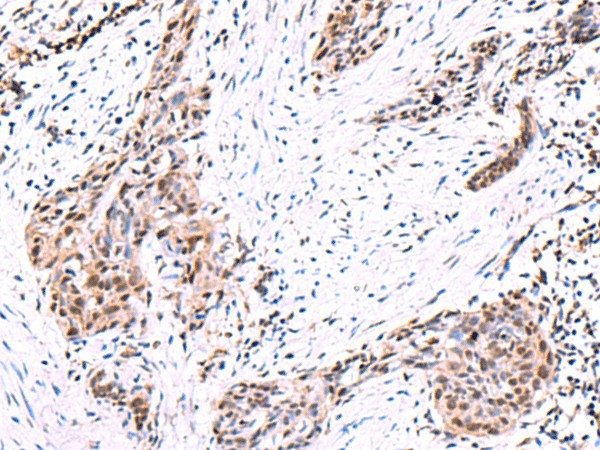 POLD2 Polyclonal Antibody (E-AB-19055)