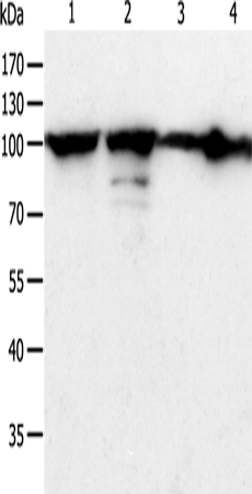 HSP90B1 Polyclonal Antibody (E-AB-14114)