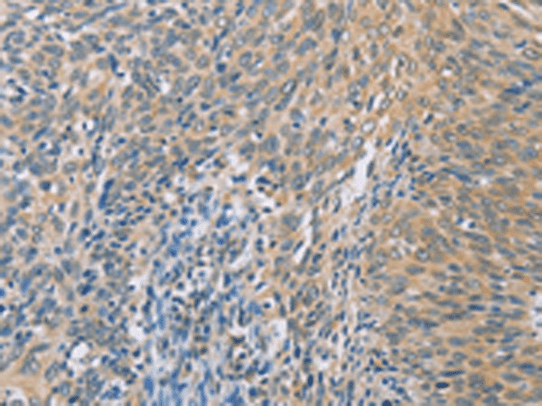 ZHX3 Polyclonal Antibody (E-AB-53237)