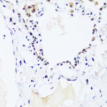 BRIX1 Polyclonal Antibody (E-AB-66291)