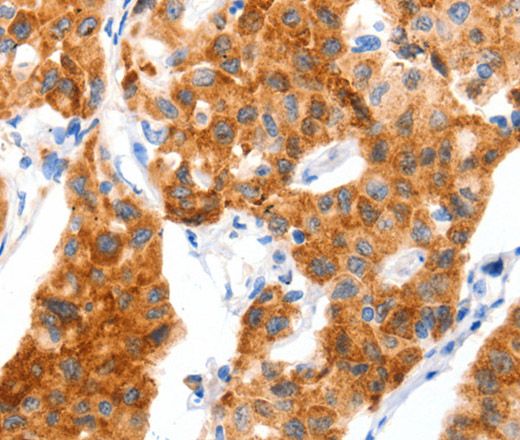 GLUT-4 Polyclonal Antibody (E-AB-12477)