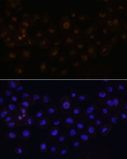 HEY1 Polyclonal Antibody (E-AB-66694)