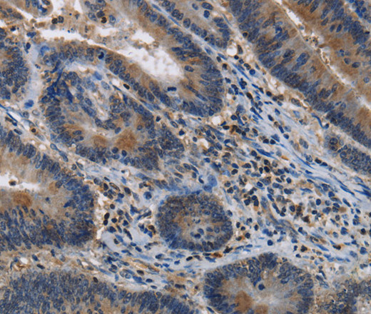 ITPR2 Polyclonal Antibody (E-AB-13345)