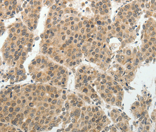 SOCS7 Polyclonal Antibody (E-AB-15856)
