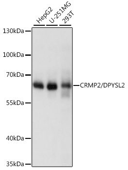 (KO Validated) CRMP2/DPYSL2 Polyclonal Antibody (E-AB-90888)