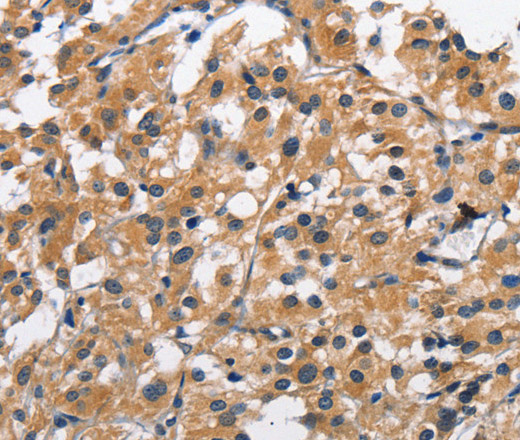 CLEC2D Polyclonal Antibody (E-AB-10241)
