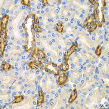 CNPY3 Polyclonal Antibody (E-AB-61565)