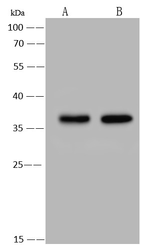 Recombinant RANKL Monoclonal Antibody (AN300240P)