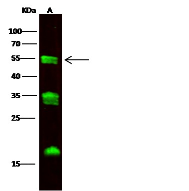 Recombinant Carboxypeptidase M Monoclonal Antibody (AN300393P)