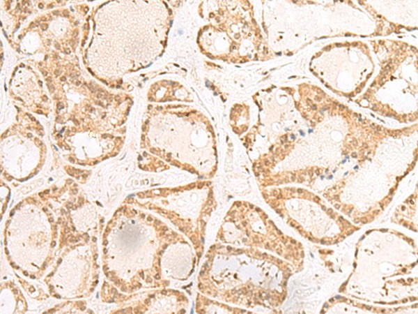 RBM19 Polyclonal Antibody (E-AB-52785)