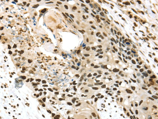 TALDO1 Polyclonal Antibody (E-AB-17133)