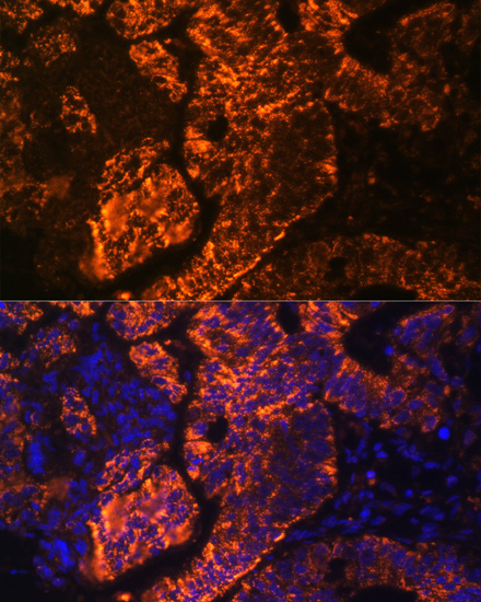 TNFRSF25 Polyclonal Antibody (E-AB-64966)
