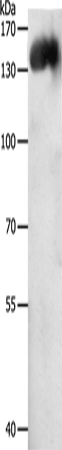 CD31 Polyclonal Antibody (E-AB-12617)
