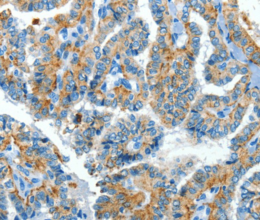 CLPTM1L Polyclonal Antibody (E-AB-16347)