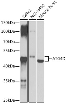 ATG4D Polyclonal Antibody (E-AB-92420)