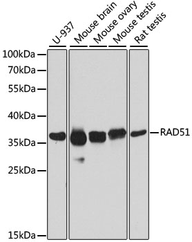RAD51 Polyclonal Antibody (E-AB-62189)