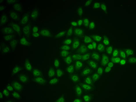 BTG1 Polyclonal Antibody (E-AB-61904)