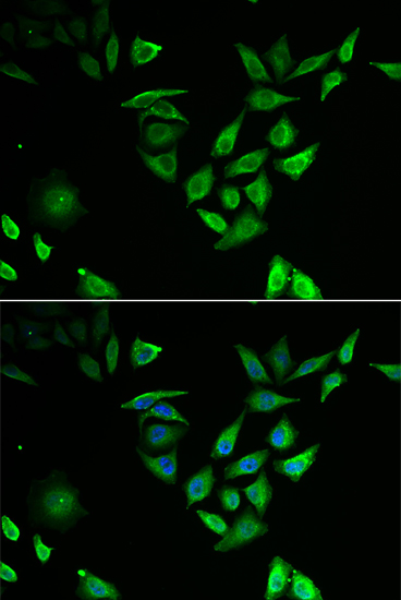 NUTF2 Polyclonal Antibody (E-AB-64728)