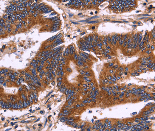 KIR2DL1/3/4/S4 Polyclonal Antibody (E-AB-11044)