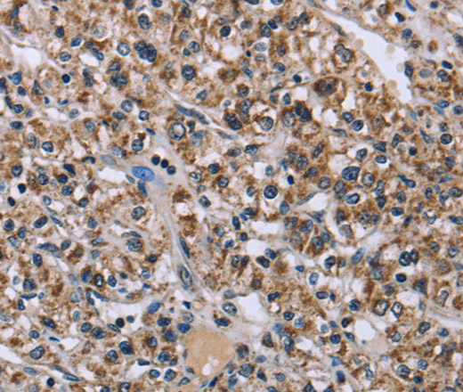 KCNJ11 Polyclonal Antibody (E-AB-14986)