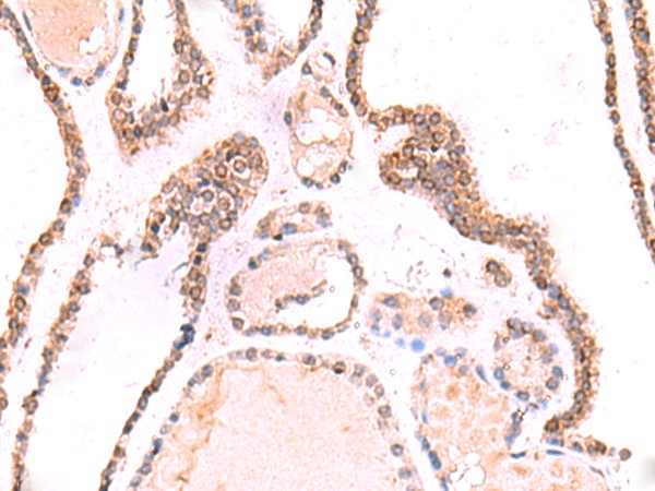 TOR1AIP1 Polyclonal Antibody (E-AB-19051)