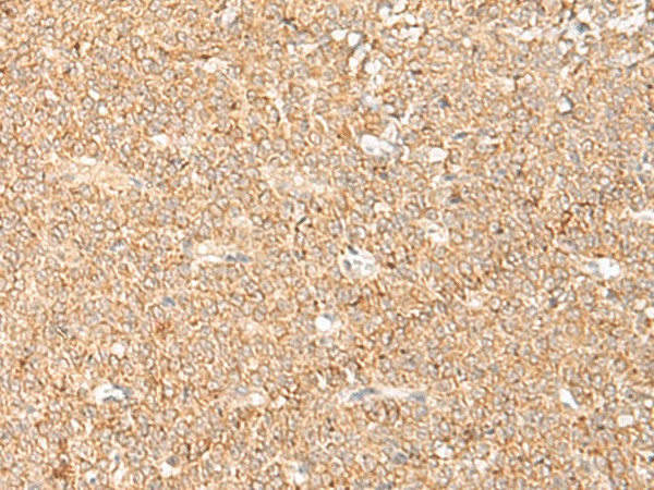 LGALSL Polyclonal Antibody (E-AB-18059)